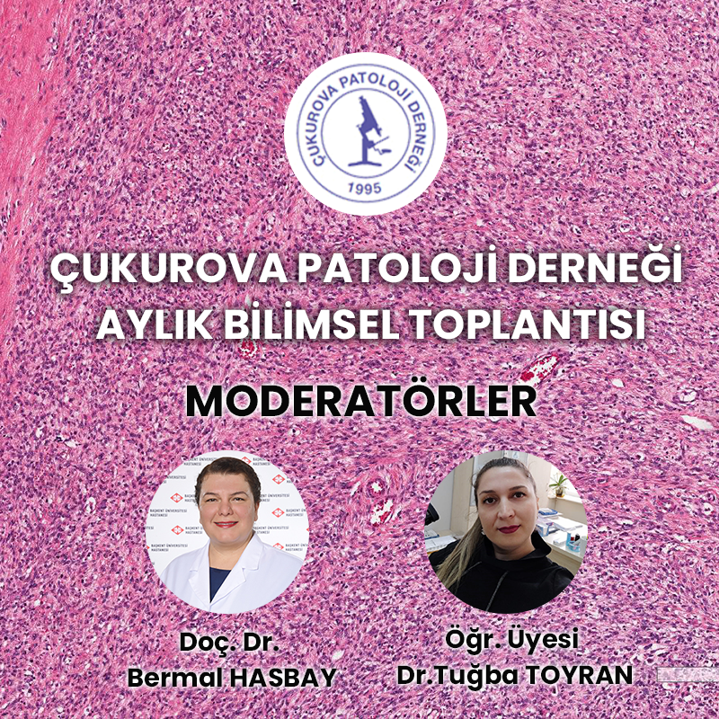ÇUKUROVA PATOLOJİ DERNEĞİ AYLIK BİLİMSEL TOPLANTISI